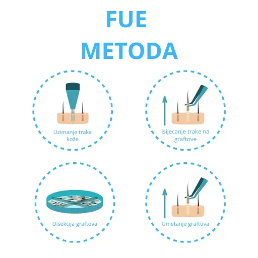 FUE METODA
